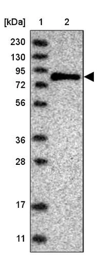 Lane 1: Marker [kDa] 230, 130, 95, 72, 56, 36, 28, 17, 11_br/_Lane 2: Human cell line RT-4