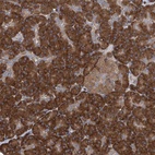 Anti-SENP2 Antibody