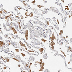 Anti-TMEM63B Antibody