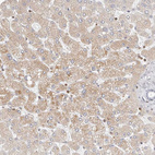 Immunohistochemical staining of human liver shows moderate cytoplasmic positivity in hepatocytes.