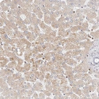 Immunohistochemical staining of human liver shows moderate cytoplasmic positivity in hepatocytes.