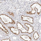 Immunohistochemical staining of human kidney shows strong membranous positivity in cells in tubules.