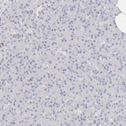 Immunohistochemical staining of human pancreas shows no membranous positivity in exocrine glandular cells as expected.