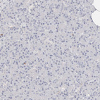Anti-TMEM63B Antibody