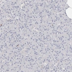 Immunohistochemical staining of human pancreas shows no membranous positivity in exocrine glandular cells as expected.