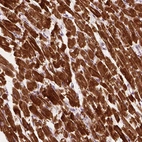 Anti-MLIP Antibody