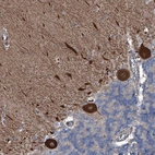 Anti-KIF13A Antibody