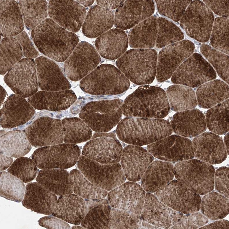 Anti-KIFC2 Antibody