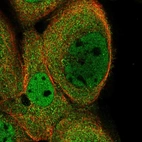 Immunofluorescent staining of human cell line A-431 shows localization to nucleoplasm & cytosol.
