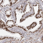 Anti-SRP19 Antibody