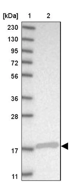 Lane 1: Marker [kDa] 230, 130, 95, 72, 56, 36, 28, 17, 11_br/_Lane 2: Human cell line RT-4