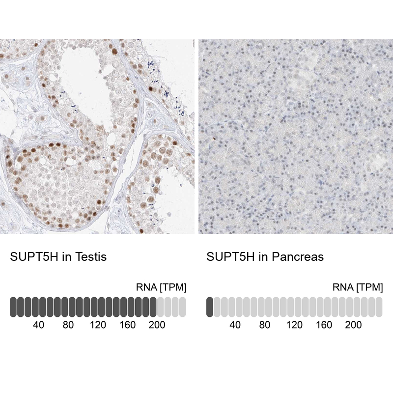 Anti-SUPT5H Antibody