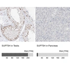 Anti-SUPT5H Antibody