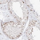 Immunohistochemical staining of human testis shows high expression.