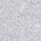 Immunohistochemical staining of human pancreas shows low expression as expected.