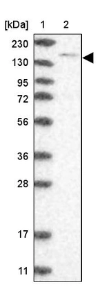 Lane 1: Marker [kDa] 230, 130, 95, 72, 56, 36, 28, 17, 11_br/_Lane 2: Human cell line RT-4