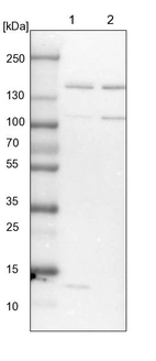 Lane 1: NIH-3T3 cell lysate (Mouse embryonic fibroblast cells)_br/_Lane 2: NBT-II cell lysate (Rat Wistar bladder tumour cells)