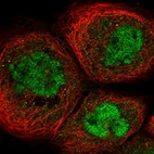 Immunofluorescent staining of human cell line A-431 shows localization to nucleoplasm.