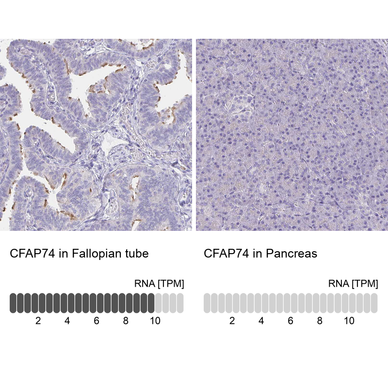 Anti-CFAP74 Antibody