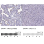 Anti-CFAP74 Antibody