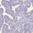 Immunohistochemical staining of human fallopian tube shows moderate positivity in cilia in glandular cells.