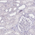 Immunohistochemical staining of human kidney shows negative membranous positivity in cells in tubules and cells in glomeruli as expected.