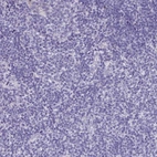 Immunohistochemical staining of human tonsil shows negative membranous positivity in non-germinal center cells and germinal center cells as expected.