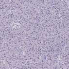 Immunohistochemical staining of human pancreas shows negative membranous positivity in exocrine glandular cells and endocrine glandular cells as expected.