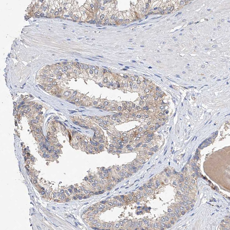 Anti-AMD1 Antibody