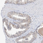 Anti-AMD1 Antibody