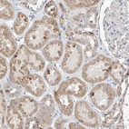 Immunohistochemical staining of human kidney shows weak granular cytoplasmic positivity in cells in tubules.