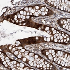 Anti-USP47 Antibody