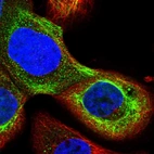 Immunofluorescent staining of human cell line A-431 shows localization to intermediate filaments.
