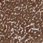 Immunohistochemical staining of human liver shows strong cytoplasmic positivity in hepatocytes.