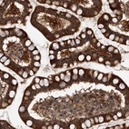 Immunohistochemical staining of human small intestine shows strong cytoplasmic positivity in glandular cells.