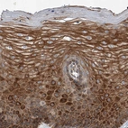 Immunohistochemical staining of human cervix shows strong cytoplasmic positivity in squamous epithelial cells.
