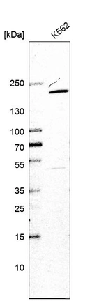 Western blot analysis in human cell line K562.