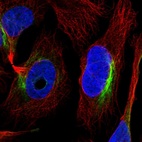 Immunofluorescent staining of human cell line U-2 OS shows localization to intermediate filaments.