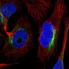 Immunofluorescent staining of human cell line U-2 OS shows localization to intermediate filaments.