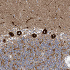 Anti-ITM2B Antibody