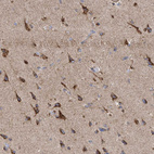 Immunohistochemical staining of human cerebral cortex shows strong granular cytoplasmic positivity in neuronal cells.