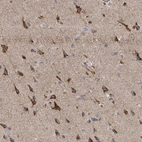 Immunohistochemical staining of human cerebral cortex shows strong granular cytoplasmic positivity in neuronal cells.