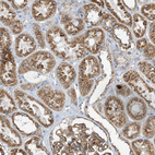 Anti-ITM2B Antibody