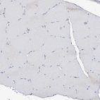 Immunohistochemical staining of human skeletal muscle shows no positivity in striated muscle fibers as expected.