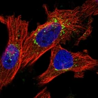 Immunofluorescent staining of human cell line U-251 MG shows localization to the Golgi apparatus & vesicles.