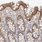 Anti-DMRT2 Antibody