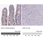 Anti-ACE Antibody