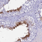 Immunohistochemical staining of human testis shows strong membranous positivity in cells in seminiferous ducts.