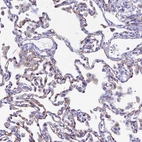 Immunohistochemical staining of human lung shows moderate membranous positivity in pneumocytes.