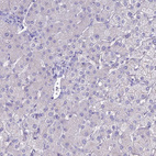 Anti-ACE Antibody